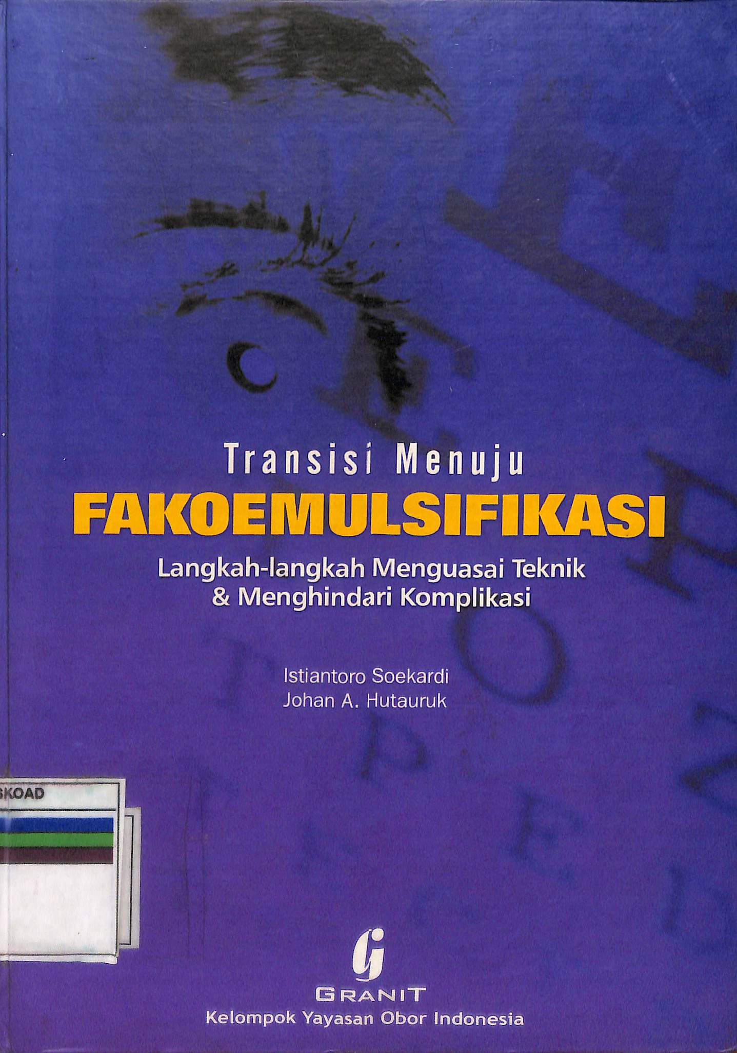 Transisi Menuju Fakoemulsifikasi